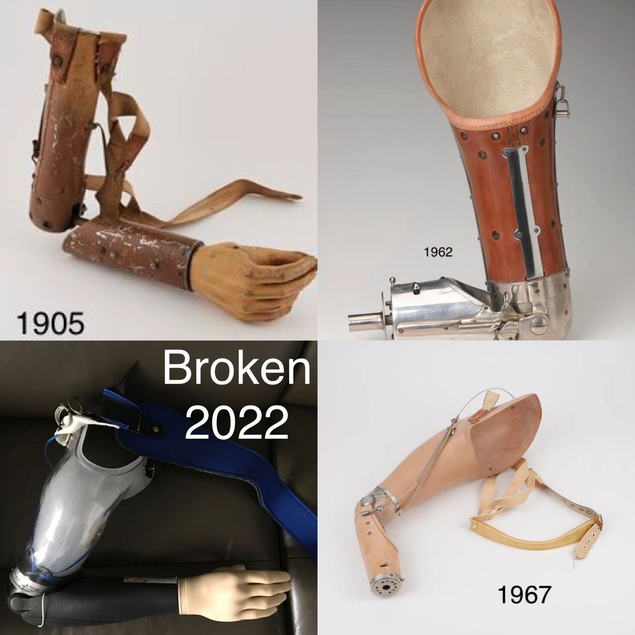 Some history of some transhumeral (above elbow) prosthetics