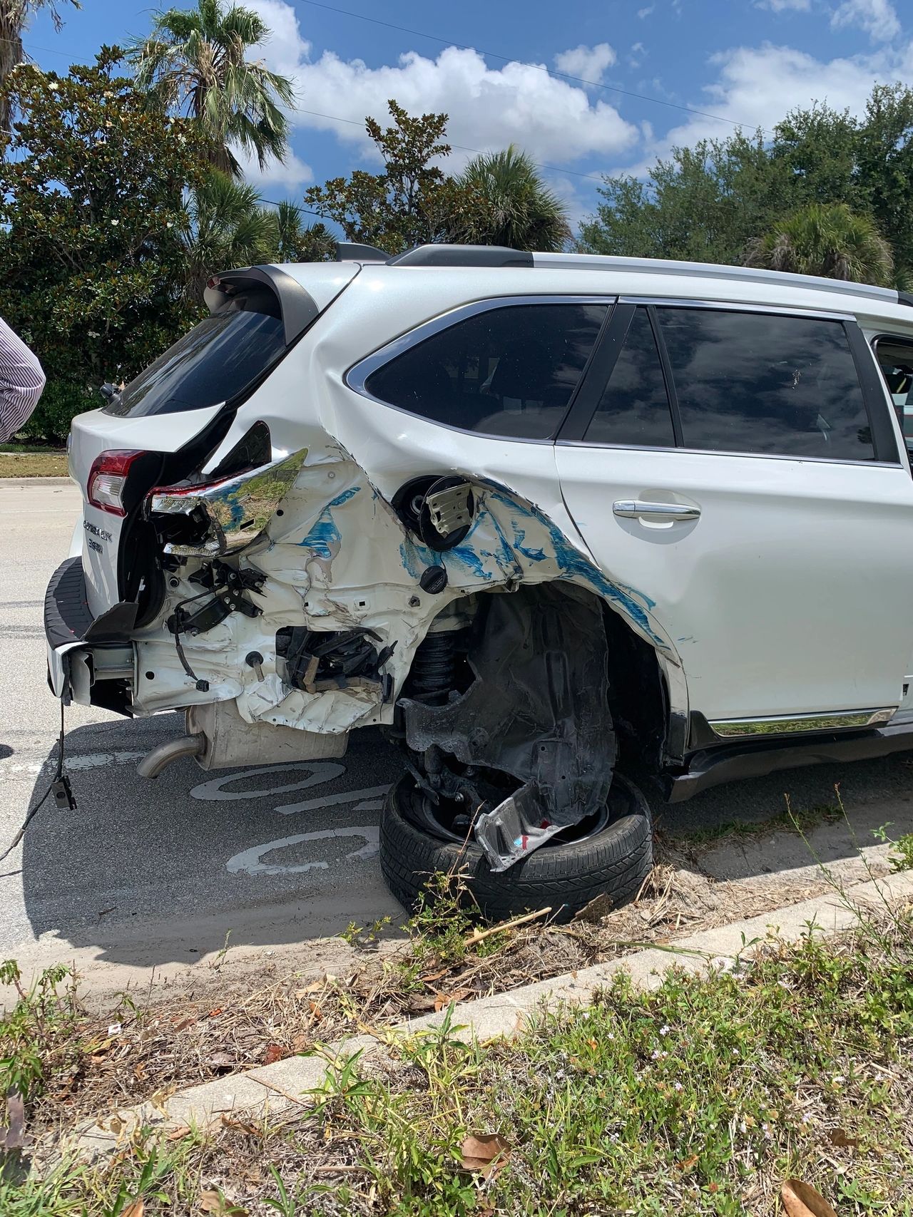 Car accident, it was totaled 